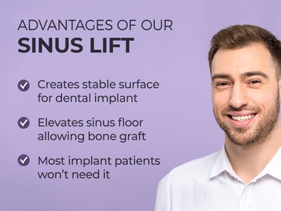 Man smiling next to text.
Text reads: Advantages of our Sinus Lift: Creates stable surface for dental implant. Elevates sinus floor allowing bone graft. Most implant patients won't need it.