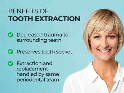 Image of smiling woman next to text.
Text reads: "Benefits of Tooth Extraction. Decreased trauma to surrounding teeth. Preserves tooth sockets. Extraction and replacement handled by same periodontal team.