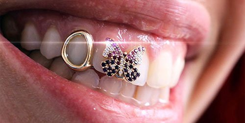 Jewelry with butterfly charm on teeth, cosmetic dental jewelry, smile enhancement.