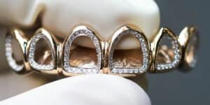 Diamond and gold grillz