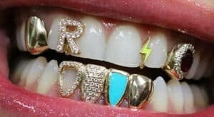 Custom Grillz